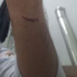 حمله به امدادگر اورژانس ۱۱۵ در کردستان توسط فرد بیمارنما